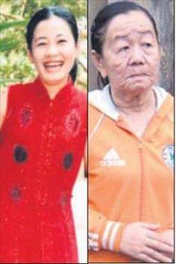 Dünyadaki en garip hastalıklar