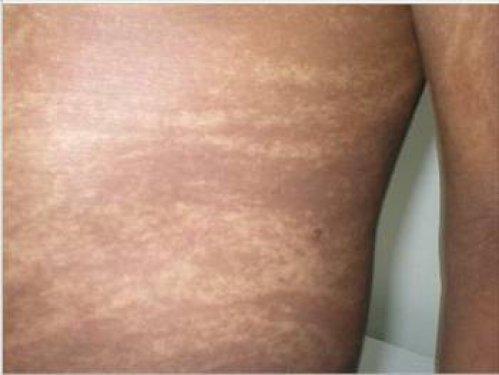 Dünyadaki en garip hastalıklar