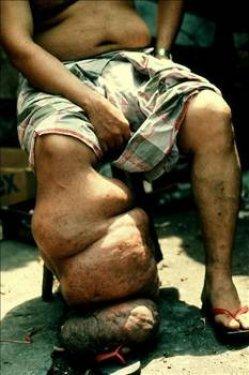 Dünyadaki en garip hastalıklar