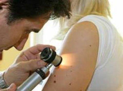 Kanserli ben nasıl anlaşılır