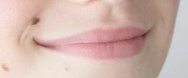 Kanserli ben nasıl anlaşılır