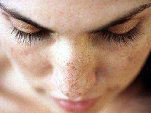 Kanserli ben nasıl anlaşılır