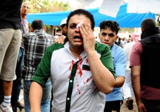 Mısır'da katliam büyüyor: 200 ölü