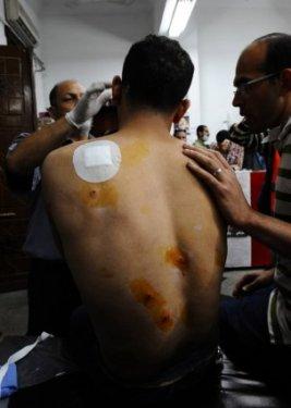 Mısır'da katliam büyüyor: 200 ölü