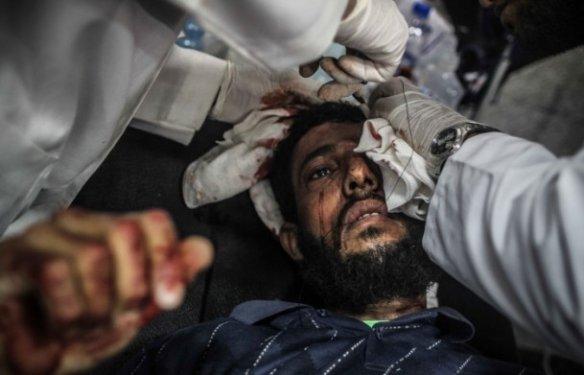 Mısır'da katliam büyüyor: 200 ölü