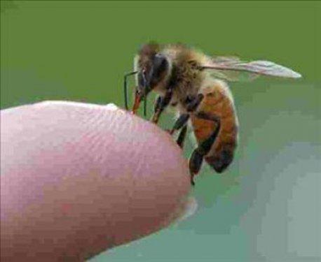 Arı sokması nelere şifa oluyor ?