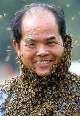 Arı sokması nelere şifa oluyor ?