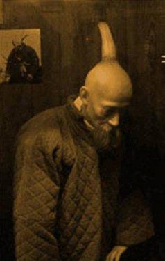 Milyonda bir görülen hastalıklar