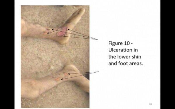 Suriye'deki savaş suçuna ilişkin ilk görüntüler - +18