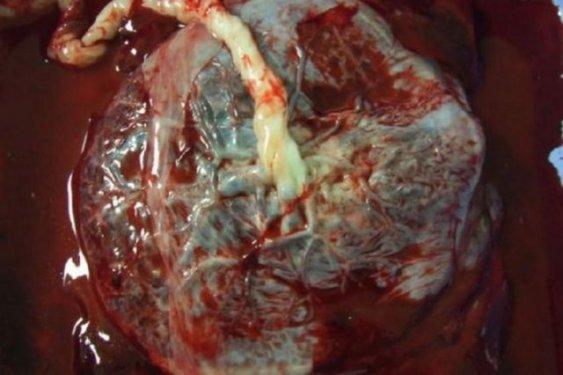 Aç kalmayı tercih edeceğiniz en iğrenç yemekler