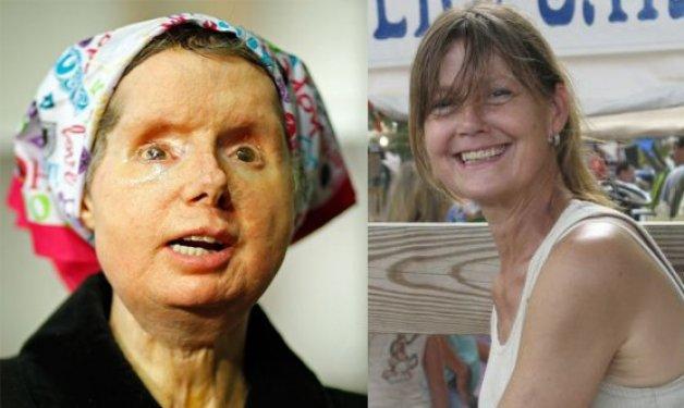 Bir şempanze bu kadının hayatını mahvetti