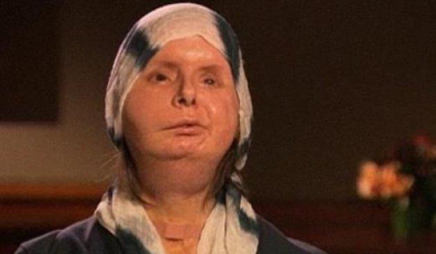 Bir şempanze bu kadının hayatını mahvetti