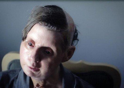 Bir şempanze bu kadının hayatını mahvetti