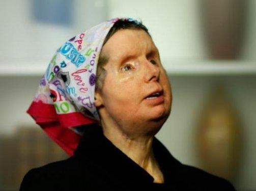 Bir şempanze bu kadının hayatını mahvetti