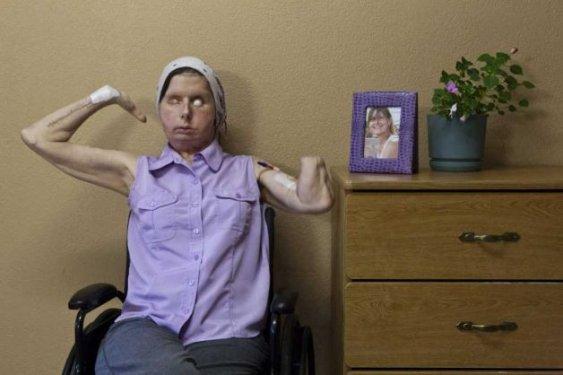 Bir şempanze bu kadının hayatını mahvetti