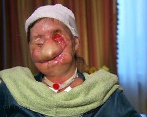 Bir şempanze bu kadının hayatını mahvetti