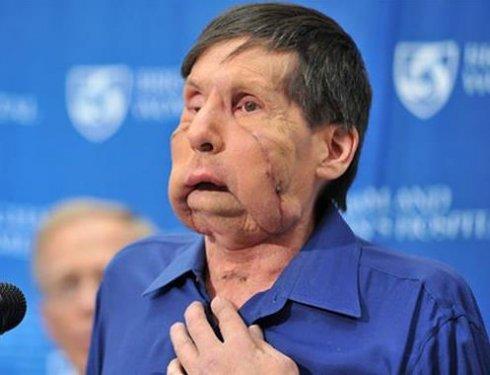 Bir şempanze bu kadının hayatını mahvetti