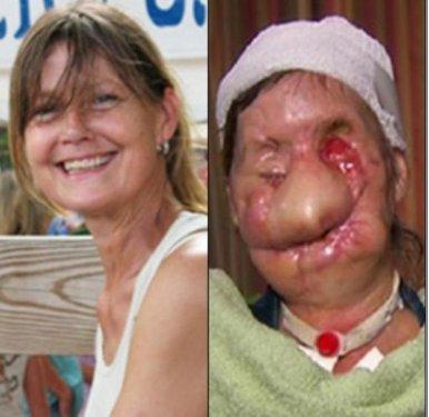 Bir şempanze bu kadının hayatını mahvetti