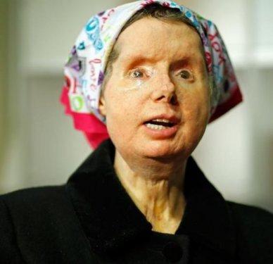 Bir şempanze bu kadının hayatını mahvetti