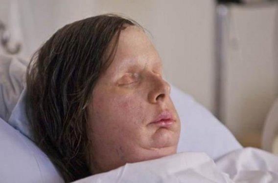 Bir şempanze bu kadının hayatını mahvetti