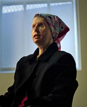 Bir şempanze bu kadının hayatını mahvetti