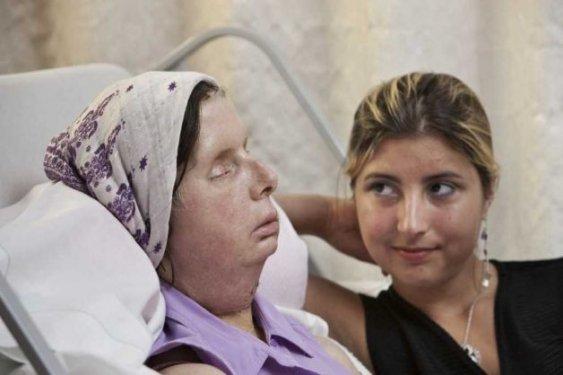 Bir şempanze bu kadının hayatını mahvetti