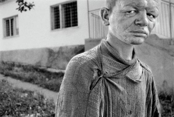 Savaşın insanlar üzerindeki korkunç etkisi