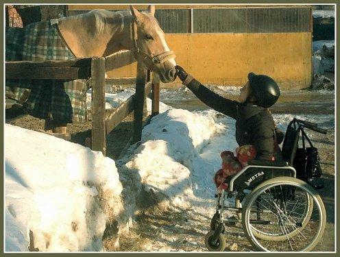 Bu güzel kız acı  hikayesine rağmen pes etmedi 