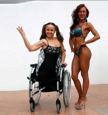 Bu güzel kız acı  hikayesine rağmen pes etmedi 