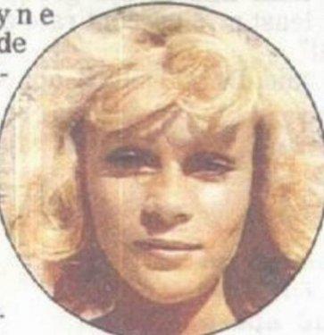 Botoksu fazla kaçıran ünlüler 