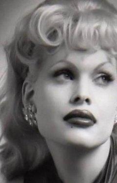 Botoksu fazla kaçıran ünlüler 