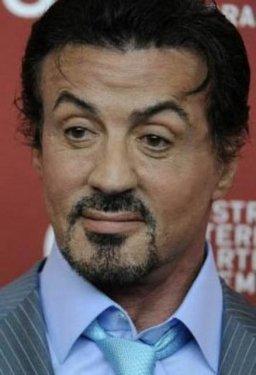 Botoksu fazla kaçıran ünlüler 