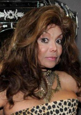 Botoksu fazla kaçıran ünlüler 