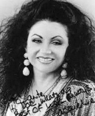 Botoksu fazla kaçıran ünlüler 