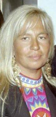 Botoksu fazla kaçıran ünlüler 