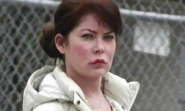 Botoksu fazla kaçıran ünlüler 