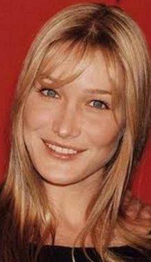 Botoksu fazla kaçıran ünlüler 