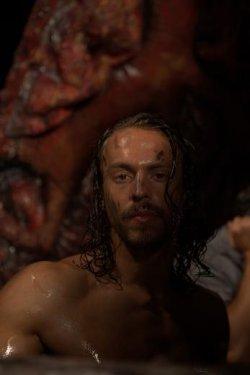 Medcezir'in Orkun'u Metin Akdülger tanınmaz halde