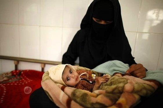 Kadın olmanın sıkıntılı olduğu 22 ülke