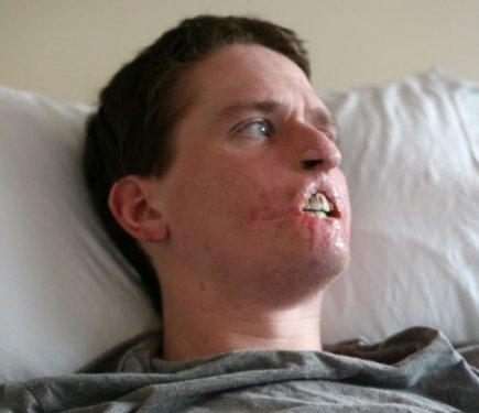 Et yiyen bakteri 4ay da bu hale getirdi