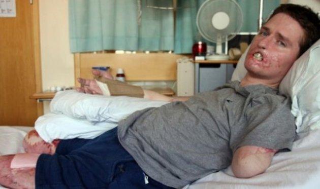 Et yiyen bakteri 4ay da bu hale getirdi