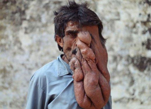 Chana Lal fil adam olarak anılıyor