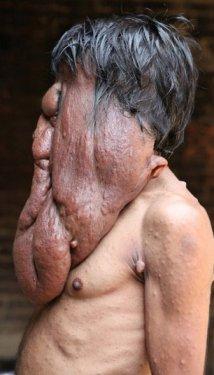 Chana Lal fil adam olarak anılıyor