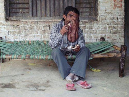 Chana Lal fil adam olarak anılıyor