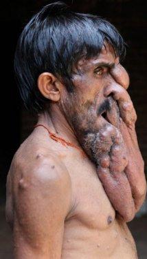 Chana Lal fil adam olarak anılıyor