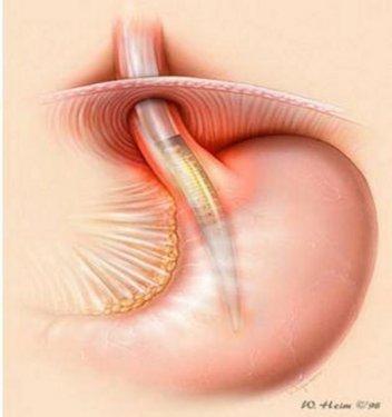 Organlarımız ne kadar sürede kendini yeniler