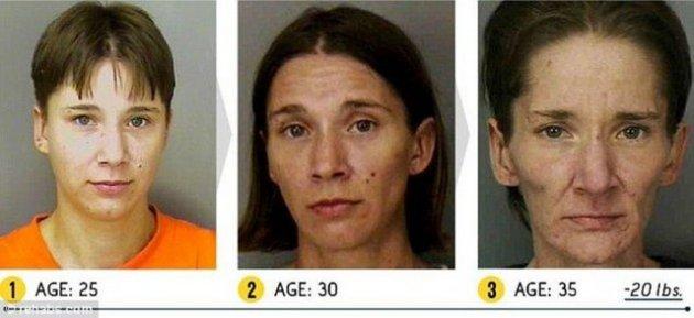 Uyuşturucu kullananların korkunç sonu