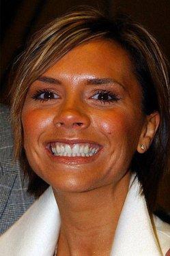 Sadece dişlerin değişimi ile evrim geçiren ünlüler