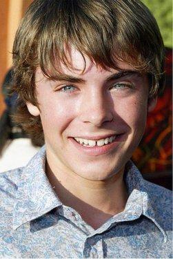 Sadece dişlerin değişimi ile evrim geçiren ünlüler