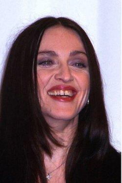 Sadece dişlerin değişimi ile evrim geçiren ünlüler